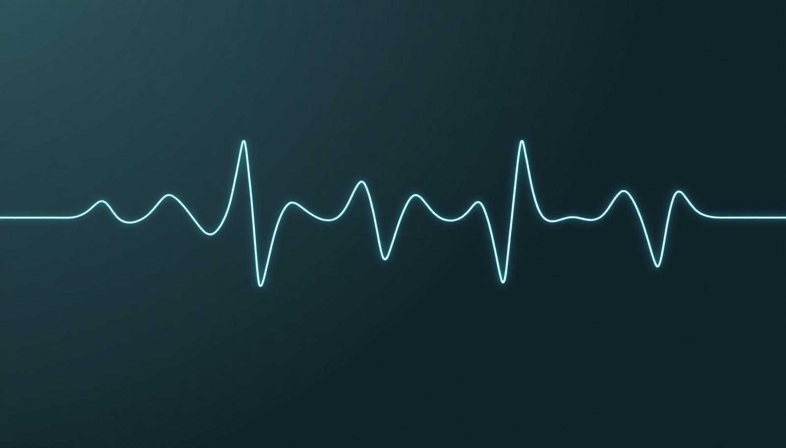 A glowing teal wave trace across a dark background, representing EEG alpha band activity
